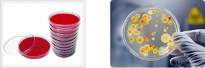 Microbial Culture Media